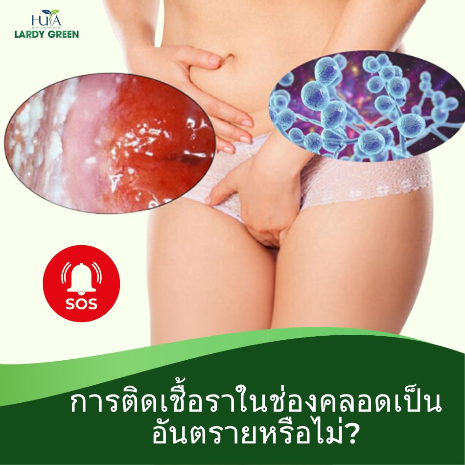 การติดเชื้อราในช่องคลอดเป็นอันตรายหรือไม่?