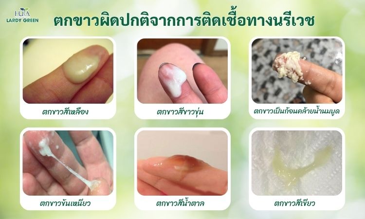ประเภทของตกขาว
