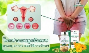 โรคปากมดลูกอักเสบ