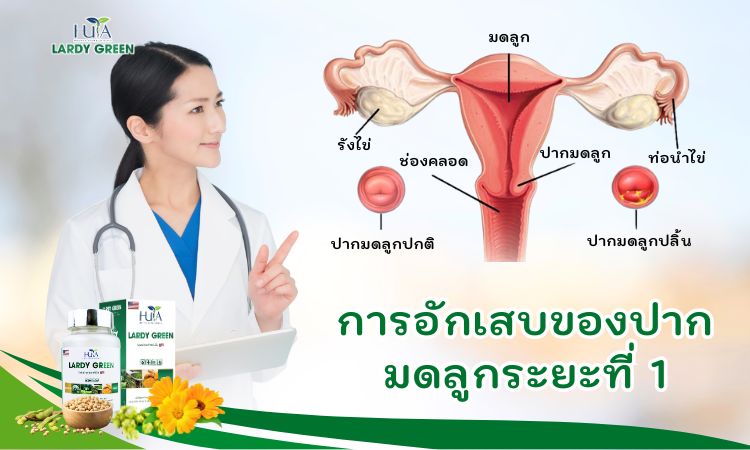 โรคเยื่อบุปากมดลูกอักเสบระยะที่ 1