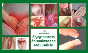 สัญญาณอาการอักเสบช่องคลอดจากแบคทีเรีย