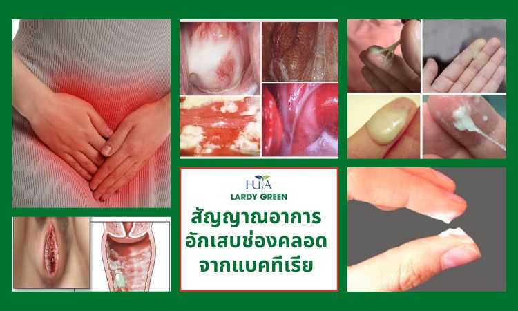 สัญญาณอาการอักเสบช่องคลอดจากแบคทีเรีย