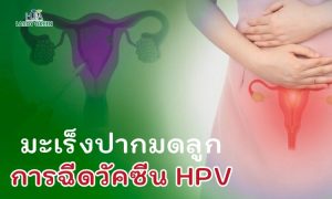 มะเร็งปากมดลูกและวัคซีน HPV