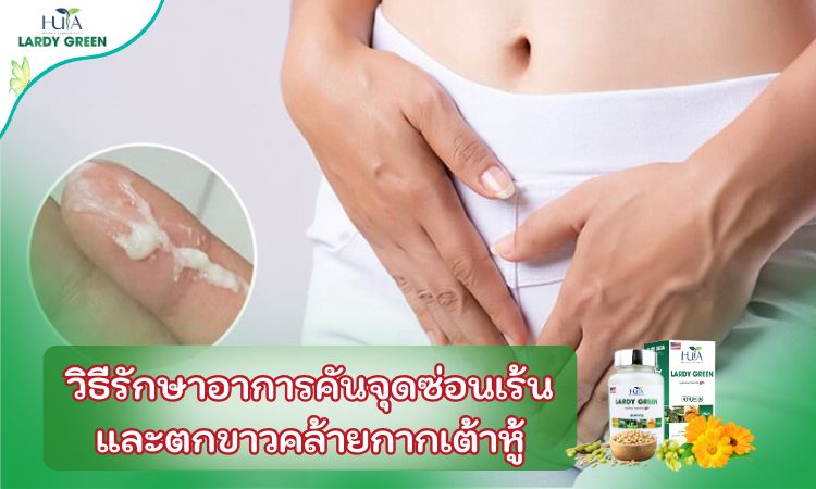 วิธีรักษาอาการคันจุดซ่อนเร้นและตกขาวคล้ายกากเต้าหู้