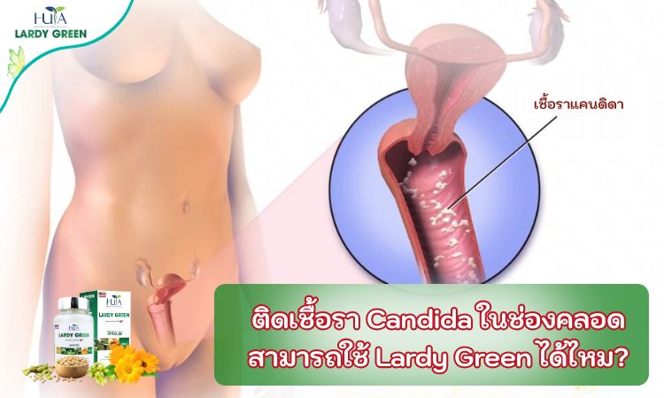 ติดเชื้อรา Candida ในช่องคลอด สามารถใช้ Lardy Green ได้ไหม?