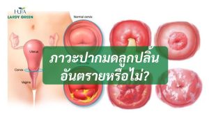 ภาวะปากมดลูกปลิ้นอันตรายหรือไม่?